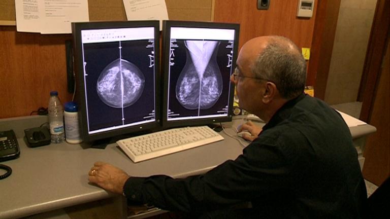 El cribratge del càncer de mama detecta 21 casos des del 2016